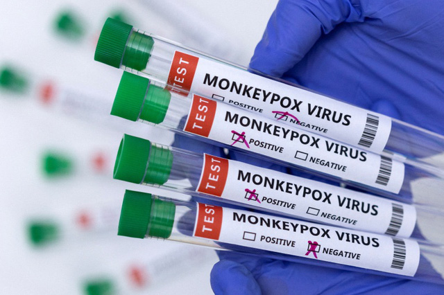 The US investigates the origin of the monkeypox epidemic that spread in this country - Photo 1.