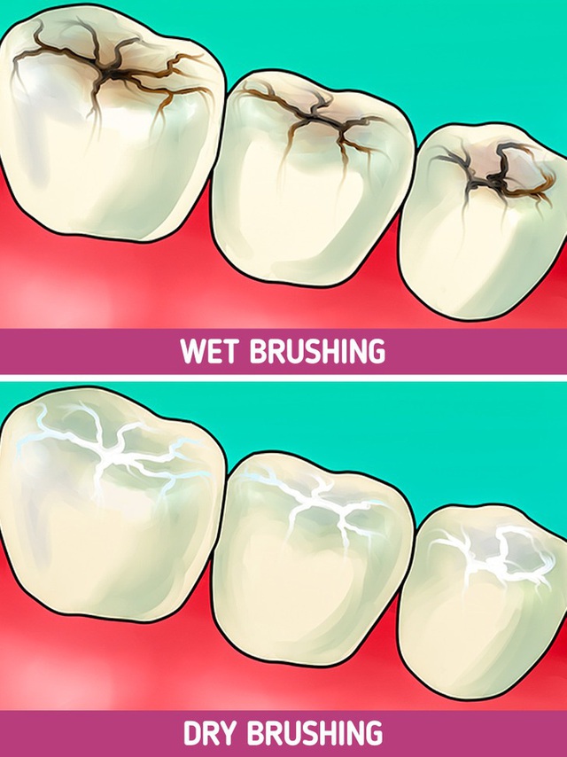 8 mẹo chăm sóc răng miệng đơn giản mà hiệu quả đến bất ngờ - Ảnh 3.