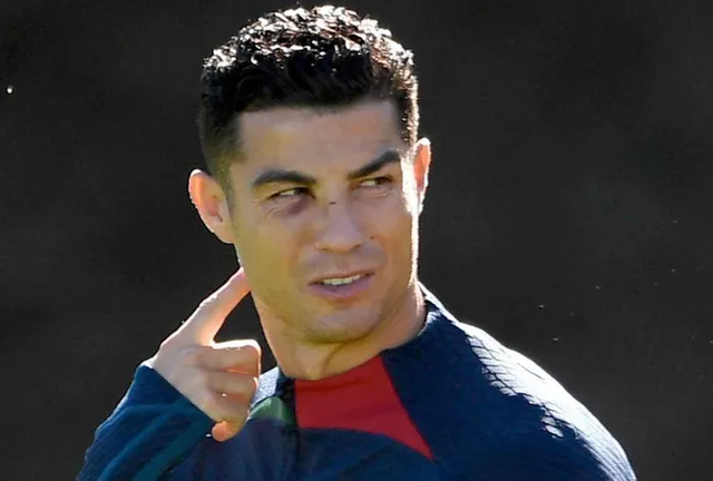 Ronaldo tập luyện với mắt thâm tím - Ảnh 3.