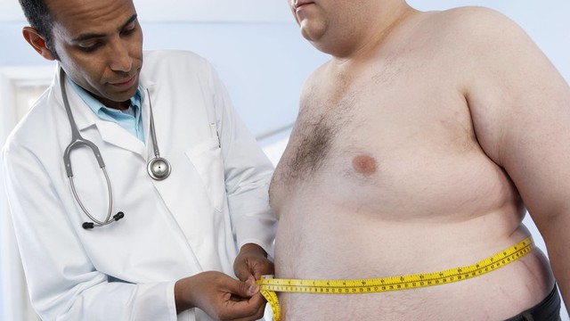 Hơn một nửa dân số thế giới sẽ bị thừa cân hoặc béo phì vào năm 2035 - Ảnh 2.