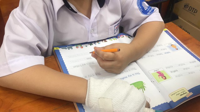 Kỷ luật cảnh cáo cô giáo đánh gãy xương ngón tay học sinh - Ảnh 1.