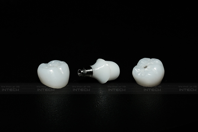 Sai lầm phổ biến khi trồng răng implant - Ảnh 1.