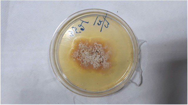 Phát hiện trường hợp đầu tiên nấm thực vật Chondrostereum purpureum lây nhiễm cho người - Ảnh 2.