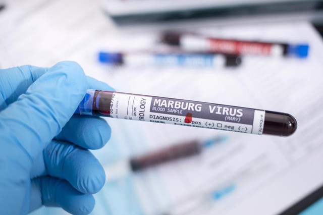 Cảnh báo nguy cơ virus Marburg lây lan từ châu Phi - Ảnh 1.