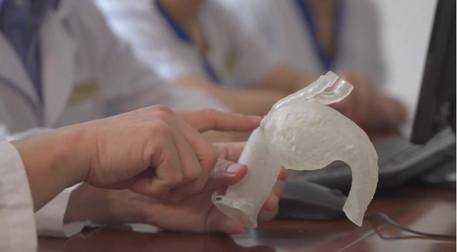 Vinmec áp dụng công nghệ 3D hỗ trợ can thiệp tim mạch lần đầu tiên ở Đông Nam Á - Ảnh 1.