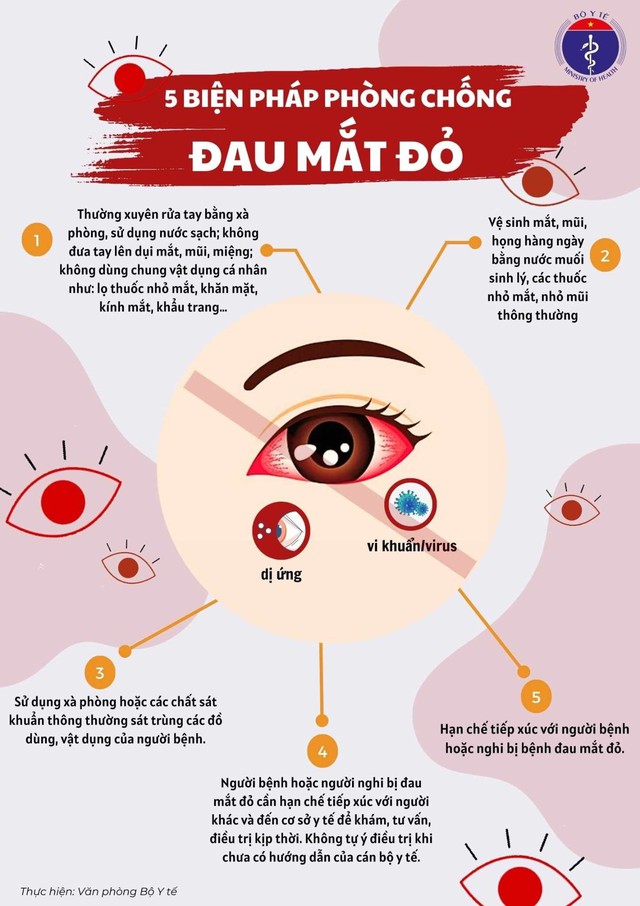 Infographic: 5 biện pháp phòng bệnh đau mắt đỏ - Ảnh 1.
