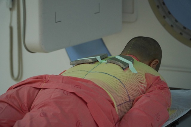 Lần đầu tiên tại Việt Nam điều trị thành công cho bệnh nhân ung thư hạch - Ảnh 2.