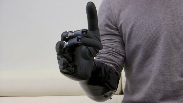 Cánh tay robot giúp người khuyết tật tự sinh hoạt - Ảnh 1.
