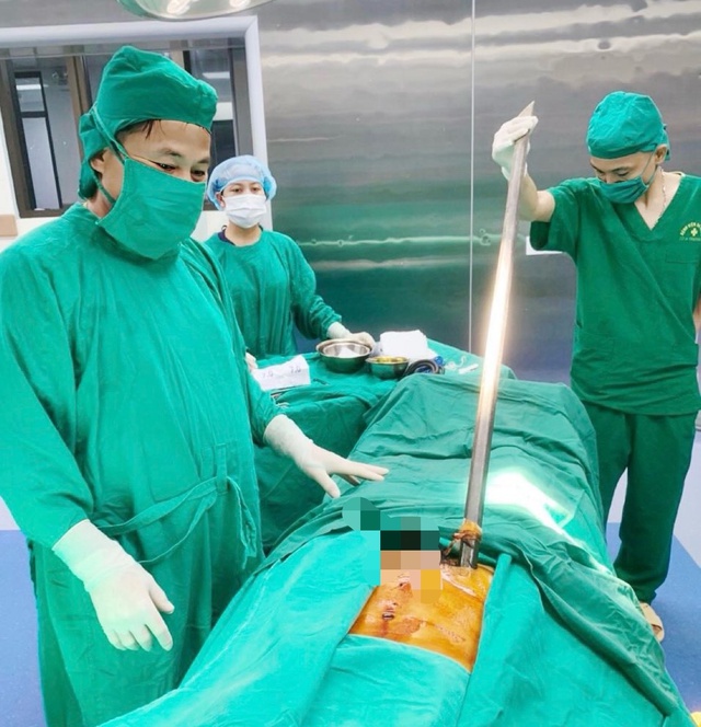 Phẫu thuật cấp cứu nam bệnh nhân bị xà beng đâm xuyên thành bụng - Ảnh 1.