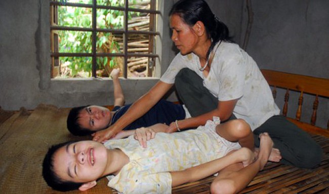 A mother takes care of her two children affected by Agent Orange in the central Vietnamese province of Quang Tri in this file photo.