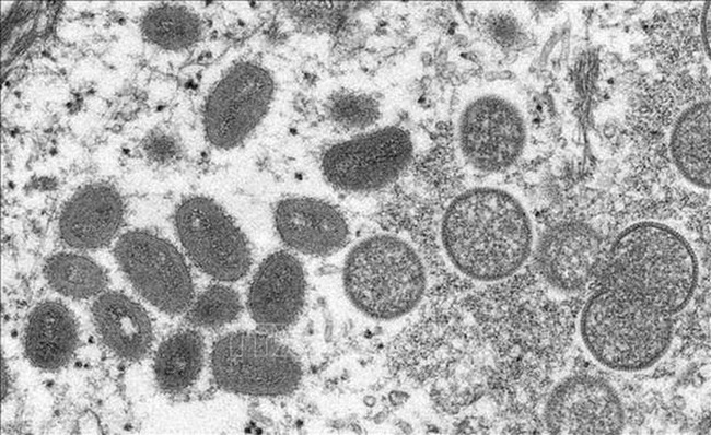 Image of monkeypox virus under an electron microscope. (Photo: AFP/VNA)