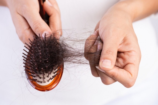 Rụng tóc ở giai đoạn ngừng phát triển của tóc TE