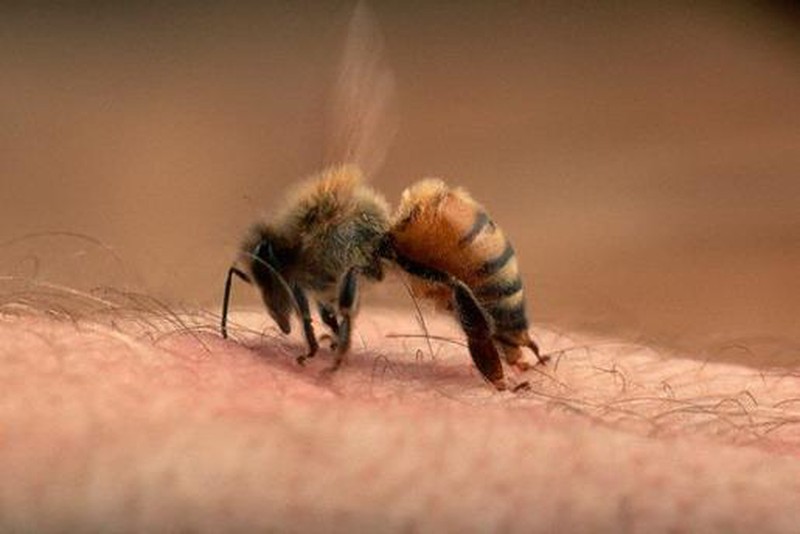 Ong đốt có thể là mối nguy hiểm đối với sức khỏe của chúng ta, nhưng hãy xem hình ảnh này để tìm hiểu cách hiệu quả để ngăn chặn chúng.