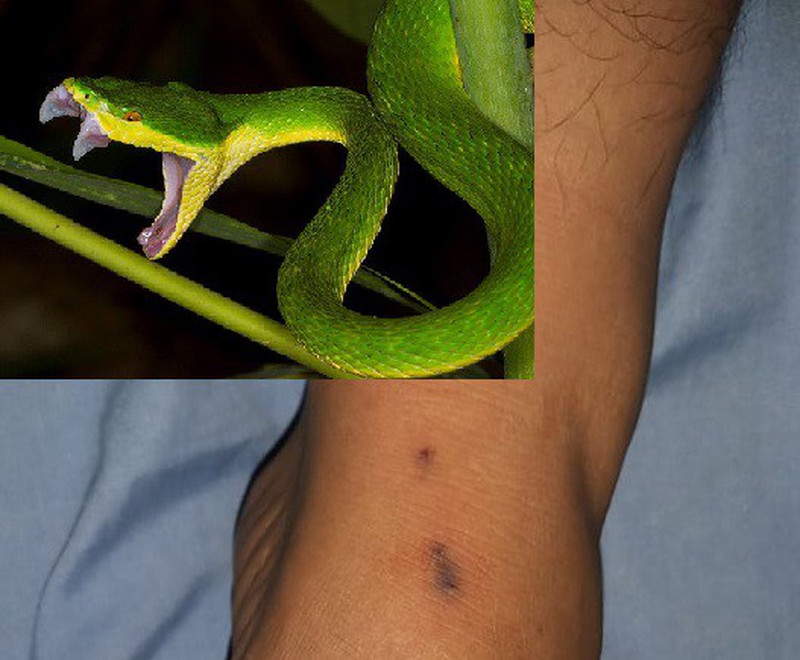 Rắn độc: Thách thức sự can đảm của bạn khi đối diện với loài rắn độc, những sinh vật đầy sức mạnh và nguy hiểm. Xem hình ảnh để hiểu rõ hơn về đặc điểm lạ thường của chúng.