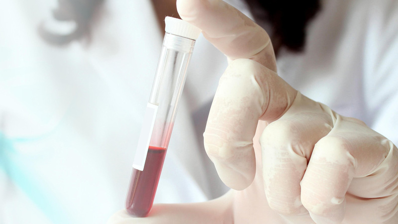 Phương pháp chẩn đoán nhiều bệnh từ xét nghiệm máu | VTV.VN