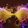 Cell therapy to treat cancer