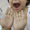 Hand, foot and mouth disease outbreak in Malaysia