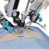 Robotics surgery benefits patients
