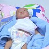 Successful operation saves newborn baby with congenital heart disease