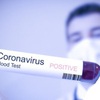 PTV updates on new coronavirus cases in Vietnam