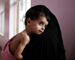 LHQ cảnh báo nạn đói lớn nhất thế giới tại Yemen
