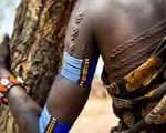 Nhức nhối nạn tấn công tình dục ở Nam Sudan
