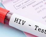 Trung Quốc: Gần 70.000 người nhiễm mới HIV/AIDS chỉ trong nửa đầu năm 2017