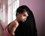 85.000 trẻ em dưới 5 tuổi thiệt mạng do nạn đói tại Yemen