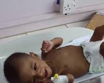 Những đứa trẻ bị mắc kẹt trong cuộc khủng hoảng tại Yemen