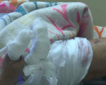 Vụ nổ ở Bắc Ninh: Nhặt đầu đạn sót lại, một người dân bị dập nát bàn tay, nhiều mảnh đạn găm vào cơ thể