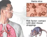 Bùng phát dịch bệnh lây từ chuột sang người ở Argentina