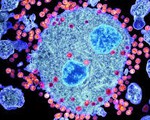 Liệu pháp gien sử dụng tế bào gốc tạo máu trong điều trị HIV/AIDS