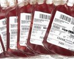 Người nhóm máu O dễ tử vong hơn khi bị chấn thương