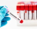 Nâng cao chất lượng xét nghiệm và sàng lọc bệnh tan máu bẩm sinh