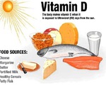 Còi xương do thiếu vitamin D ở trẻ em