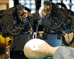 Hà Lan chế tạo robot phẫu thuật khoan hộp sọ