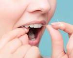 9 cách đơn giản để ngăn ngừa sâu răng
