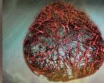Phát triển thành công mạch máu 3D giúp chữa trị bệnh