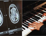 Bệnh nhân chơi piano trong lúc được mổ não