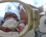 Em bé sinh ra từ thai phụ bị chết não 3 tháng
