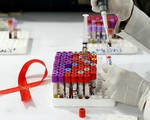 Tỷ lệ tử vong do HIV/AIDS trên thế giới có xu hướng giảm