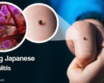 Hàn Quốc cảnh báo viêm não Nhật Bản bùng phát trên toàn quốc