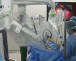 Phẫu thuật nội soi bằng robot cho bệnh nhân ung thư
