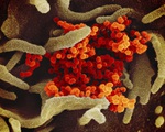 WHO công bố tên của loại virus gây ra dịch bệnh COVID-19 là SARS-COV 2