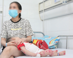 Bệnh viện Nhi Trung ương đang điều trị hơn 300 trẻ mắc tay chân miệng