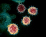 Chủng virus SARS-CoV-2 lây lan ở châu Âu tiếp tục biến thể