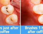 7 lời khuyên từ chuyên gia giúp răng trắng và khỏe mạnh