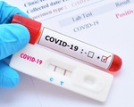 Có khả năng cho kết quả âm tính giả khi sử dụng bộ kit xét nghiệm COVID-19 nhanh