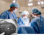 Cắt bỏ khối u buồng trứng bị hoại tử nặng khoảng 1kg cho bệnh nhân
