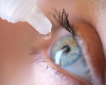 Thu hồi thuốc nhỏ mắt liên quan đến tử vong, mù lòa, hỏng nhãn cầu ở Mỹ
